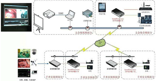 Polycom視頻會(huì)議系統(tǒng)